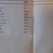 孕妇下身流白色液体正常吗,孕期出现奶白色分泌物