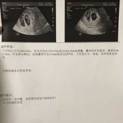 胎芽多大的时候出现胎心,胎儿胎心发育时间