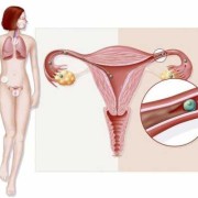孕期宫内感染的症状（孕期宫内感染的症状）