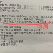 胎儿水肿可以生下来吗（怀孕12周nt12胎儿颈部水囊瘤水肿怎么办）