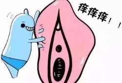 孕期阴部肿胀（怀孕中期外阴肿是怎么回事）