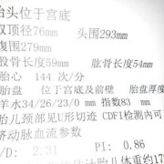 胎儿32周羊水多少正常（胎儿32周羊水多少正常值）