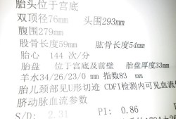 胎儿32周羊水多少正常（胎儿32周羊水多少正常值）