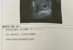 八个月胎儿没有胎心是什么原因造成的,怎样让胎儿没有胎心胎芽
