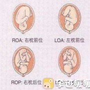 胎儿rop（胎儿rop）