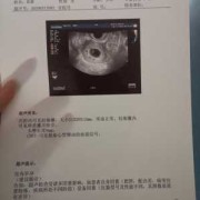 胎心偏低会影响胎儿吗（有胎芽胎心孕酮低没事吗）