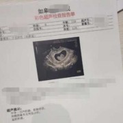 怀孕三个月胎儿彩超（三维彩超结果怎么看）