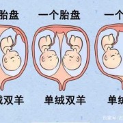 两个胎儿共用一个胎盘（单担和孖担区别）