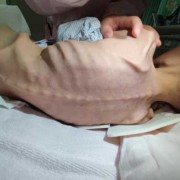 为什么一岁4个月的宝宝喝奶粉越来越瘦,皮包骨是什么原因,孕妇瘦了胎儿会瘦吗