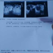 胎儿停止发育怎么办（胎儿停止发育怎么办啊）