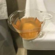 孕期尿液发红（孕期尿液发红褐色怎么回事）