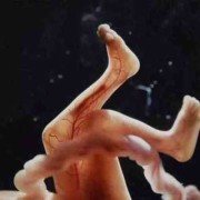 18周胎儿图片（怀孕18周胎儿图片）