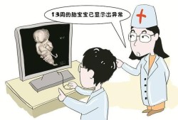 胎儿致死性侏儒症原因（胎儿致死性侏儒症原因是什么）