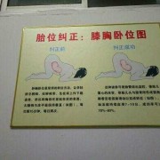 胎儿总是趴着怎么办（孕妇趴着调整胎位该怎么做好）