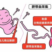 胎儿脐带血（储存脐带血生孩子是什么情况？有什么作用啊）