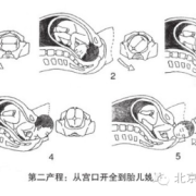 胎儿娩出的七个步骤（胎儿娩出的七个步骤衔接）