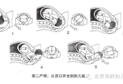 胎儿娩出的七个步骤（胎儿娩出的七个步骤衔接）