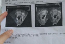 双胞胎宝宝成长记录文字,双胞胎六个月胎儿图片