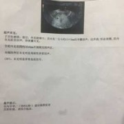 孕期出血宫腔有激液怎么办,孕期出血了