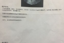 孕期出血宫腔有激液怎么办,孕期出血了