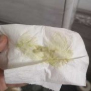 怀孕期间白带发黄怎么办,