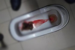 痔疮出血对胎儿有影响吗（孕晚期痔疮出血对胎儿有影响吗）