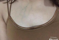 乳房青筋明显怎么回事,孕期乳房有青筋是怎么回事