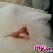 孕期见红图片（快生孩子的时候孕妇出了见红还会有什么症状）