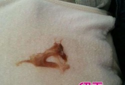 孕期见红图片（快生孩子的时候孕妇出了见红还会有什么症状）