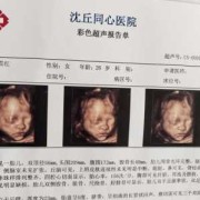 产检胎儿头偏大怎么办（孩子6个月大，看东西时总是歪着头）