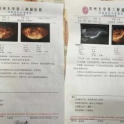 怀孕三个月做b超检查说宝宝爱动,怎么办,孕妇胎儿好动什么原因