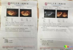 怀孕三个月做b超检查说宝宝爱动,怎么办,孕妇胎儿好动什么原因