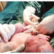 怀孕37周怎样能快点生呢？可以打催产针吗,让胎儿早点出生的办法有哪些