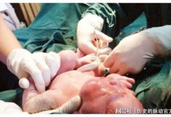 怀孕37周怎样能快点生呢？可以打催产针吗,让胎儿早点出生的办法有哪些