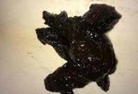 孕妇拉肚子拉黑色稀便是什么情况呢,孕期大便稀软不成形粘稠