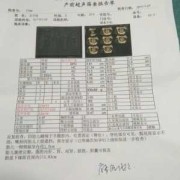 胎儿左侧侧脑室高值（胎儿侧脑室宽度正常值是多少）