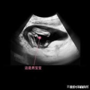 17周胎儿清晰大图（17周胎儿清晰大图男女）