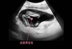 17周胎儿清晰大图（17周胎儿清晰大图男女）