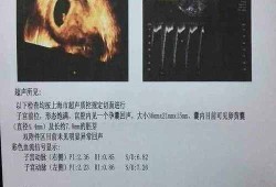 受孕多少天有胎心,胎儿一个月有胎心吗图片