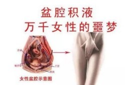 孕期盆腔积液（孕期盆腔积液）
