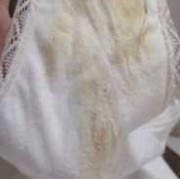 孕期白带发黄无异味