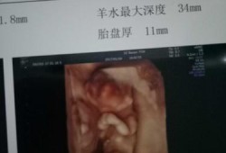 胎儿和妈妈面对面（检查说宝宝和妈妈面对面就是女孩对吗）