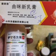 妊娠痒疹应该怎么治疗,孕期湿疹吃什么缓解痒