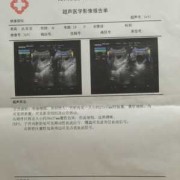 胎儿右侧囊肿（胎儿右侧囊肿是因为什么原因引起的）