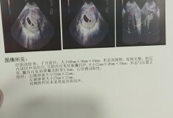 怀孕有9周了，产检结果见微弱原始心管搏动，这是什么意思,胎儿先心病是什么原因引起的