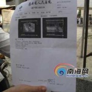 胎儿多大可以做人流（b超显示胎儿多大可以做人流）