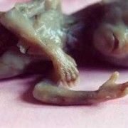 死胎儿图片（死胎儿图片九个月真实）