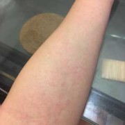 怀孕了为什么身上很痒怎么办,怀孕期间皮肤痒怎么办啊