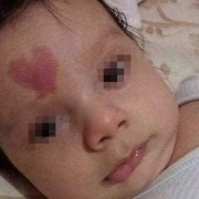 孕妇撞到肚子会有胎记吗,胎儿胎记能照出来吗图片