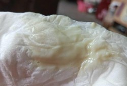 孕期流水（孕期流水状液体是什么）
